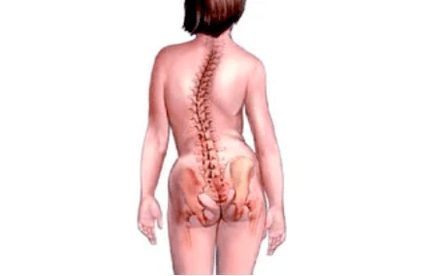 Raisons du développement de l'ostéochondrose cervicale.