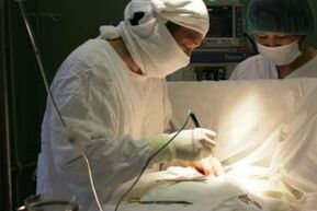 traitement chirurgical de l'arthrose du genou